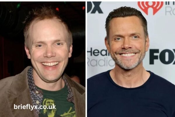 joel mchale hair surgery
