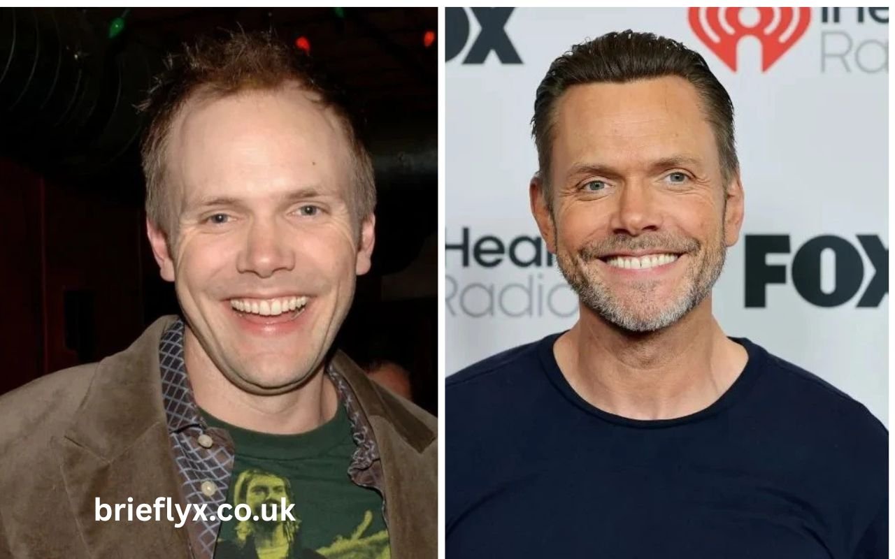 joel mchale hair surgery